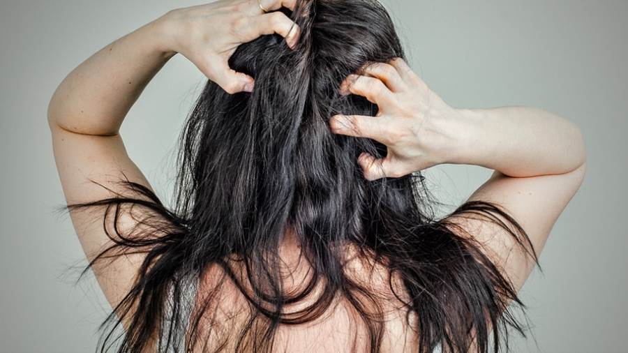 حماية فروة الرأس من الجفاف والقشرة