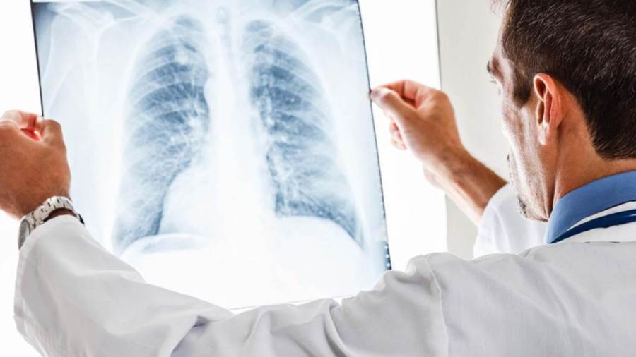 سرطان الرئة