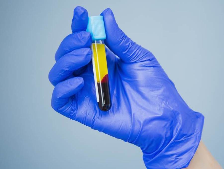 لماذا يطلب طبيبك تحليل مستويات معدن الكروم فى الدم؟