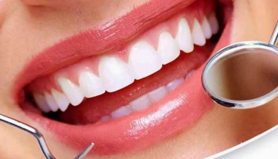 هل تنظيف الأسنان عند الطبيب ضار أم مفيد؟