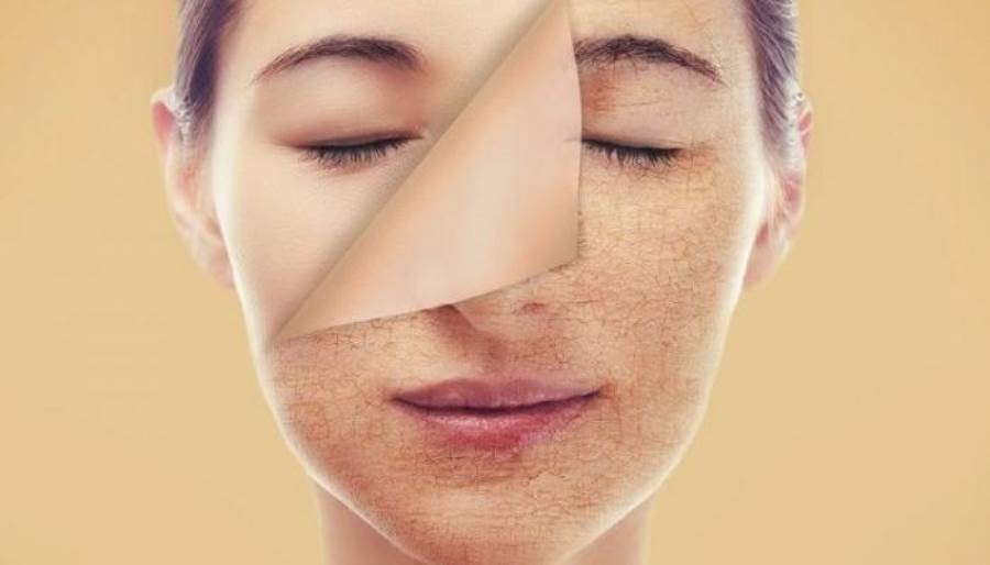 نصائح هامة لحماية بشرتك من الجفاف في الشتاء