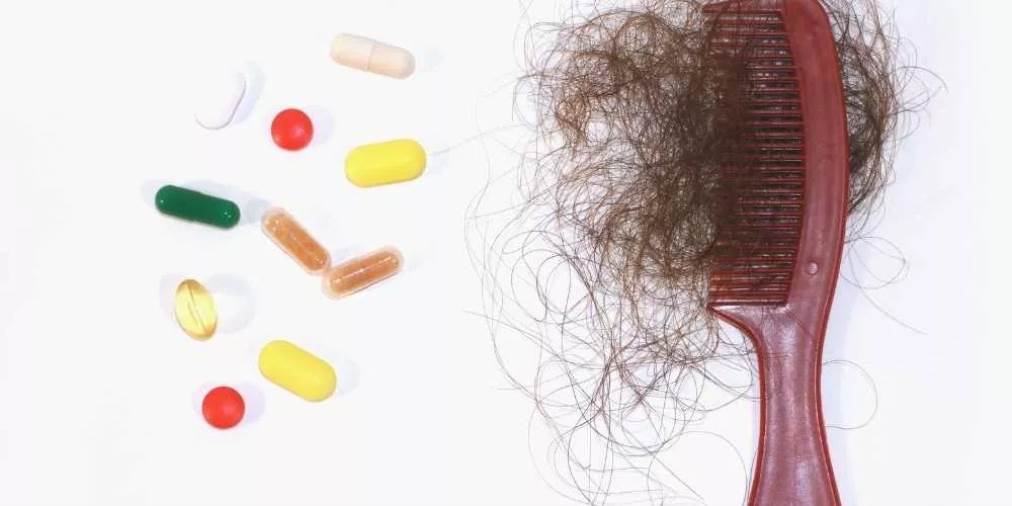  أهم 5 فيتامينات لعلاج تساقط الشعر ومشكلاته