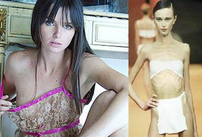 بعد وفاة آنا كارولينا بمرض فقدان الشهية .. إسبانيا تمنع مشاركة الهزيلات بعروض الأزياء خوفا على حياتهن