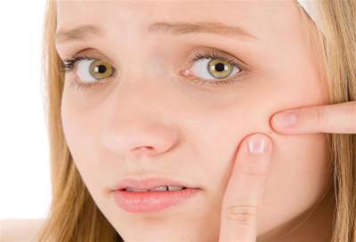 مرض لا مفر منه وقد يخلف آثاره .. الليزرأكثرعلاجات حب الشباب نجاحا