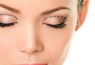 نظرة سريعة حول جراحات شد الجفون