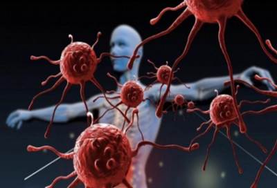 تباين حاد في معدل النجاة من السرطان في العالم