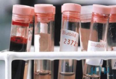 دراسة: الأطباء يفرطون في استخدام العلاج الكيماوي