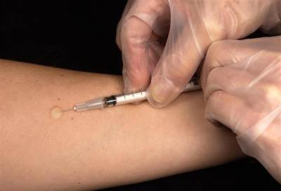 آمال جديدة في مكافحة مرض اللوكيميا الحادة (سرطان الدم)