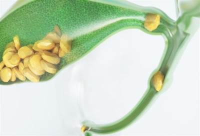 حصى المرارة وعلاقتها بالبدانة وعادات التغذية