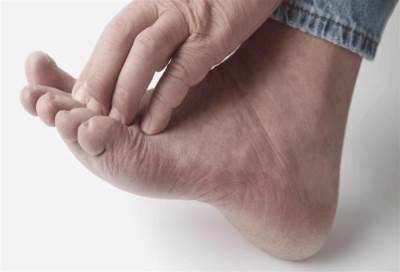 نصائح لرعاية جلد مرضى السكري