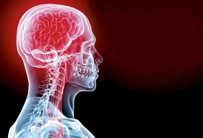 تقنية جديدة لعلاج السكتة الدماغية 