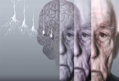 علاقة الجنكة بيلوبا بمرض الزهايمر