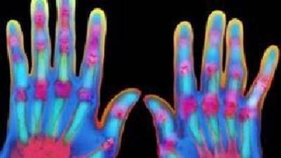 اكتشاف جديد قد يسهم في تطوير علاج للألم المزمن