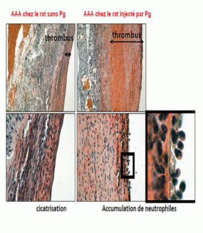 هل رعاية اللثة ضرورية لعلاج أمراض الأوعية الدموية؟