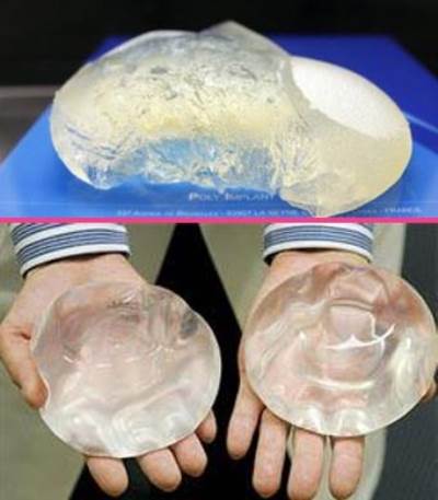 فضيحة تكبير الثدي تتصاعد .. تقارير صحافية عن حالتي وفاة و8 إصابات بالسرطان