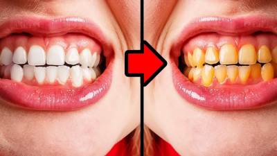 الفراولة والتفاح والعسل وقشر البرتقال.. وسيلتك لتبييض أسنانك !