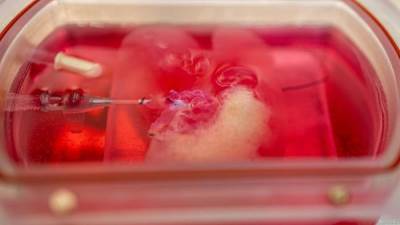 إنماء أنسجة بشرية .. من دعامات حيوانية