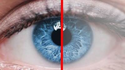 د. حازم يس : أسئلة متكررة حول المياه البيضاء