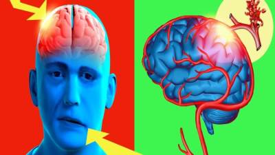 السكتة الدماغية .. تهدد المصابين بحالات انقطاع التنفس الأنسدادي