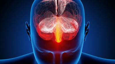 بعض آثار السكتات الدماغية تستمر لسنوات