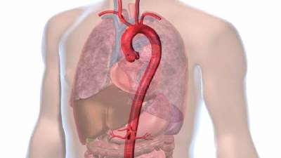 «أم الدم» في الشريان الأورطي وقوس الشريان الأبهر .. حالات مرضية قد تهدد الحياة