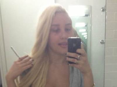  أماندا بينز : "أحتاج إلي إجراء عملية جراحية أخري لأنفي بعد رؤيتي لصورة قبيحة لي"