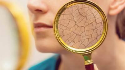 أقنعة طبيعية للتخلص من جفاف البشرة فى الشتاء