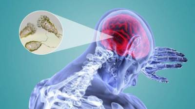 تعرف على المرض القاتل "الأميبا آكلة الدماغ"