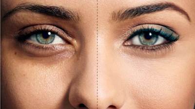 لن تصدقِي .. الملاعق الفضية للتخلص من الهالات السوداء