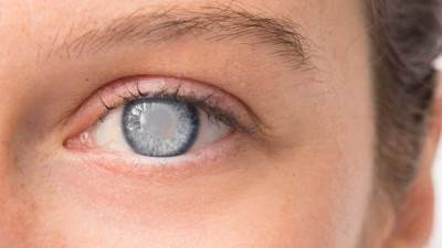  المواد المضادة للأكسدة .. كيف تقلل خطر الإصابة بإعتام عدسة العين؟