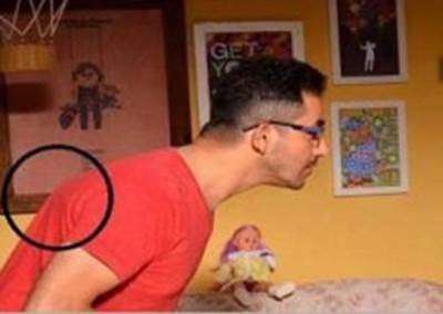 صور .. هذا هو الورم في ظهر أحمد حلمي على ذمة "متداولين"