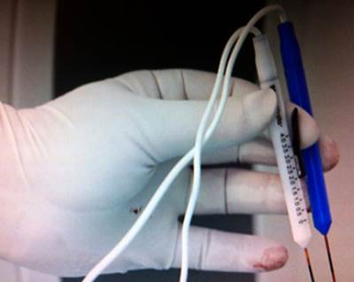 دراسة : فحص دم للكشف المبكر عن سرطان الثدي!