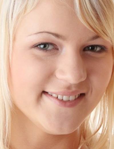 فوائد الخل للبشرة