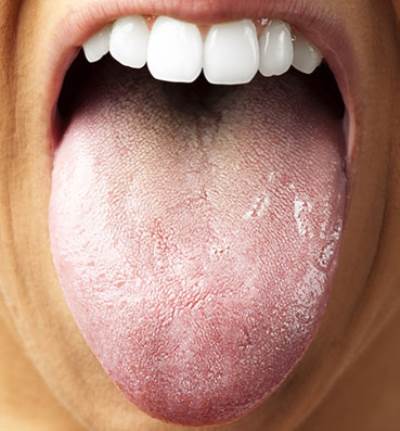 انتبه لأن لسانك مؤشر هام عن صحتك أو مرضك