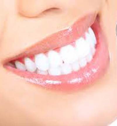 وصفات منزلية لإزالة البلاك والجير من الأسنان