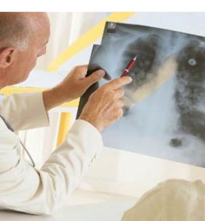 3 أطعمة فقط تحمي رئتيك من التلوث