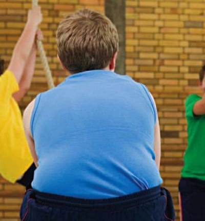 صدق أو لا تصدق .. تساؤلات طبية حول بعض فوائد السمنة