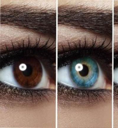  لون عينيك يُحدد المرض الذي قد تصاب به