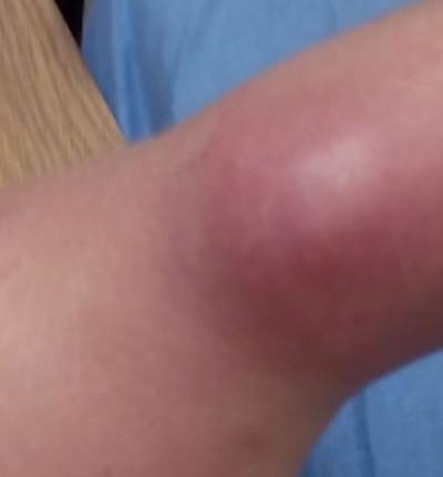 توقفي عن ارتداء ربطة الشعر حول معصمك