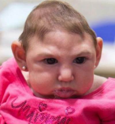 5 خطوات لوقف زحف فيروس زيكا