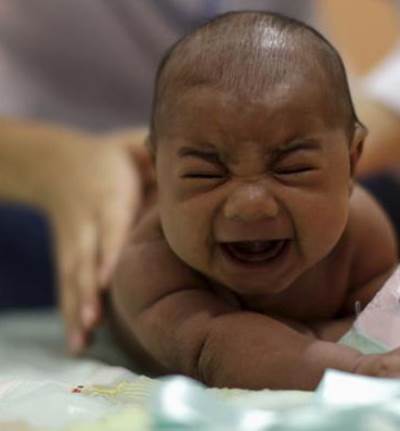 وفاة أول رضيع بمرض صغر الرأس بعد إصابته بفيروس زيكا فى بنما