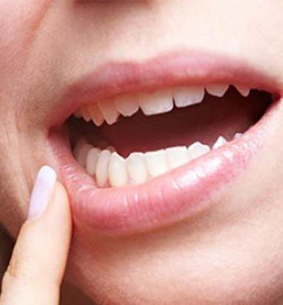 5 طرق تخلصك من تورم اللثة