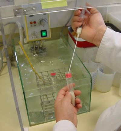 احذري .. التلقيح الصناعي يهددك بـ 5 أمراض خطيرة