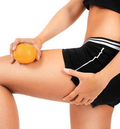 5 عادات يومية تخلصكِ من السيلوليت دون عناء