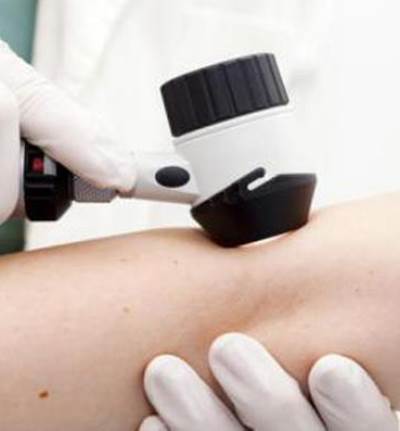 تقنية جديدة لإكتشاف مرض سرطان الجلد