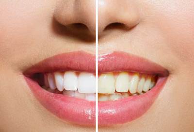 أطعمة تصبغ أسنانك وتجعلك أكبر سنا