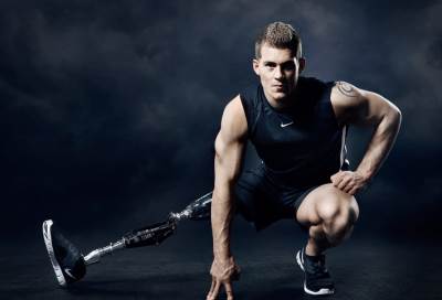 بالصور .. خسر رجله في صغره وأصبح ملك جمال إنجلترا