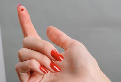 هذه المرأة تتعرق دما .. إليك التفاصيل