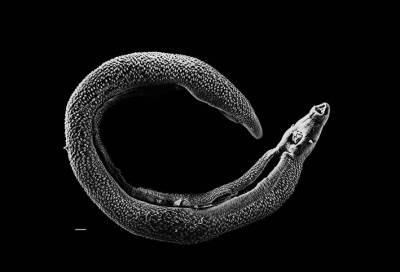 حقن متطوعين بدودة الـ "بلهارسيا" مقابل 1200 دولار