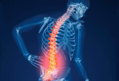 التوصل لـ 9 جينات جديدة مرتبطة بهشاشة العظام